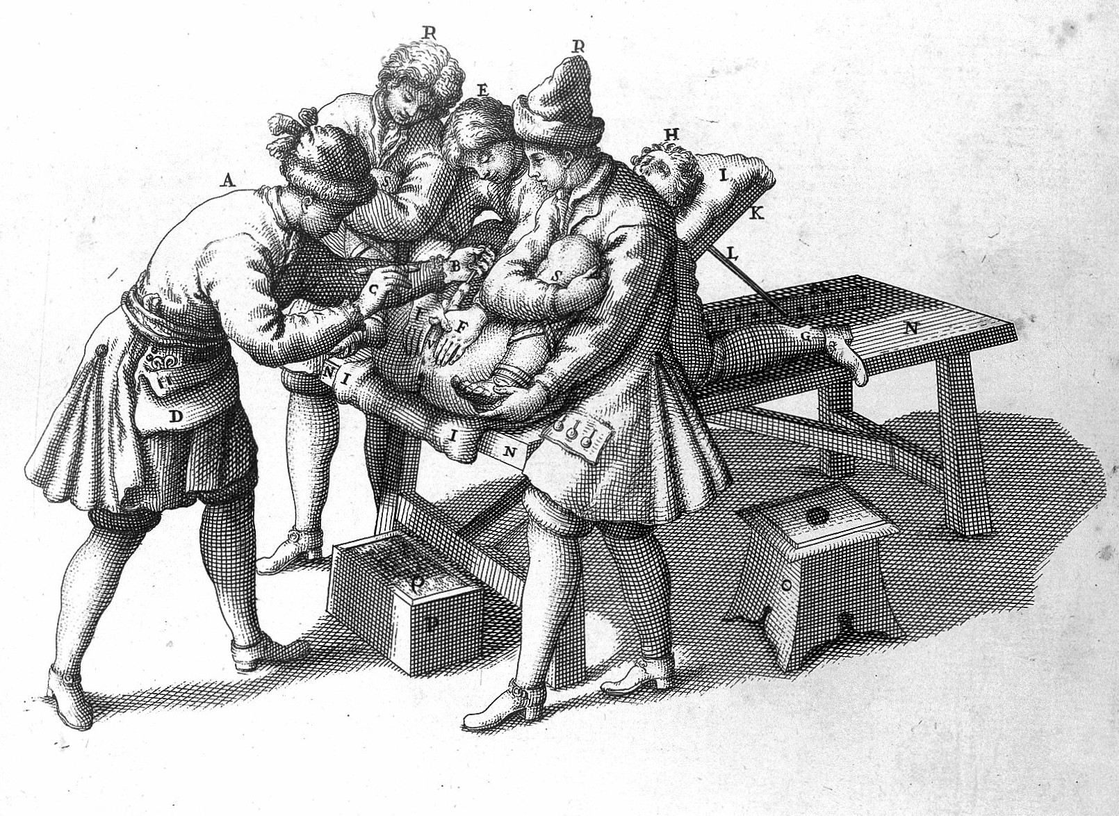 Литотомия в средние века